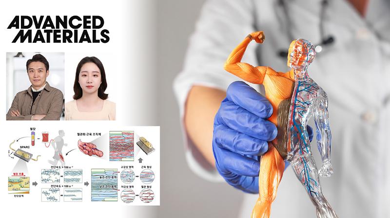 자가혈액으로 만드는 ‘맞춤형 근육-혈관’…  난치성 근육 손상 치료 새 지평